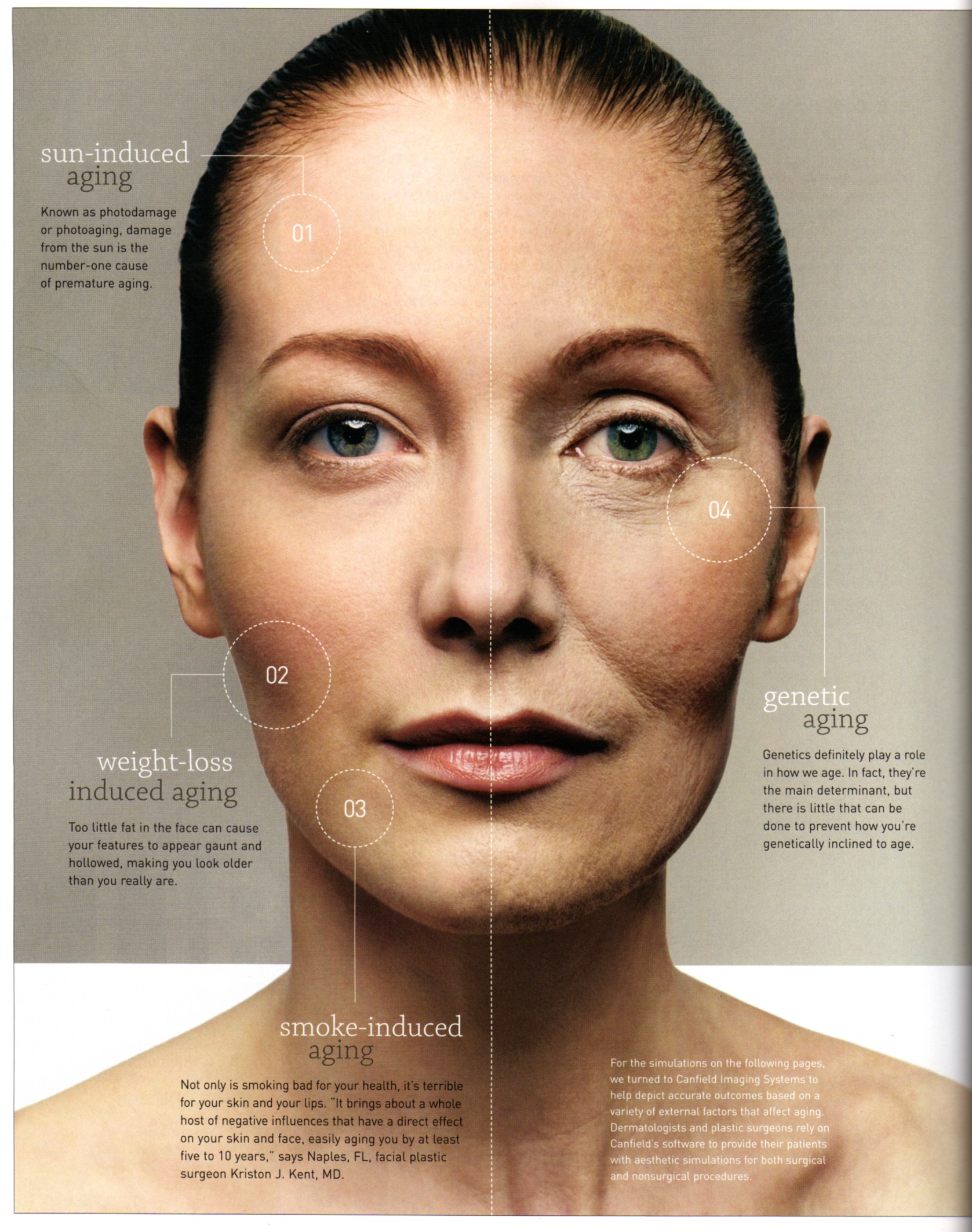 Resurfacing Facial for Sensitive Skin